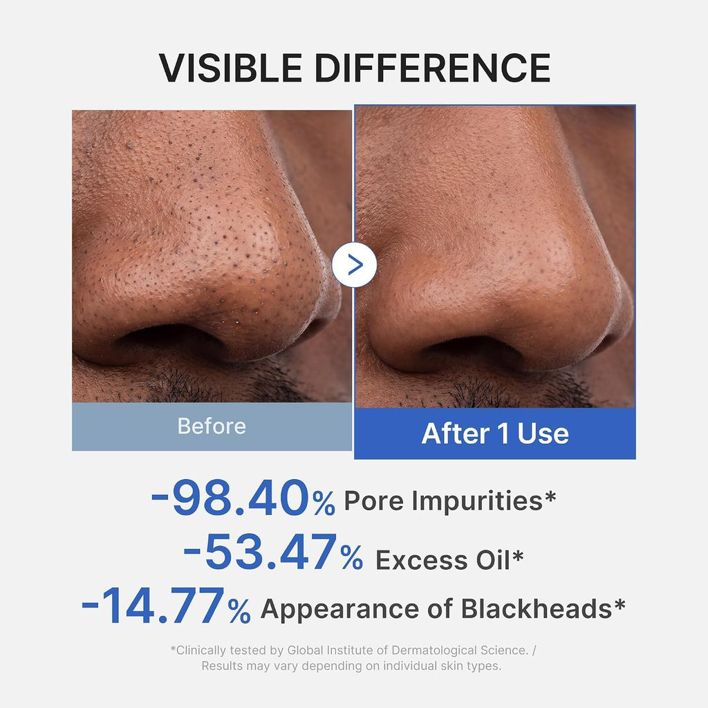 medicube Zero Pore Blackhead Mud Facial Mask