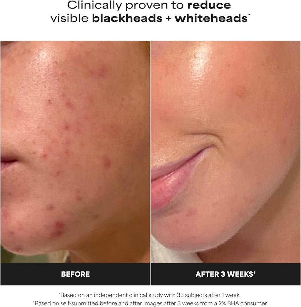 Paula's Choice SKIN PERFECTING 2% BHA Esfoliante Liquido