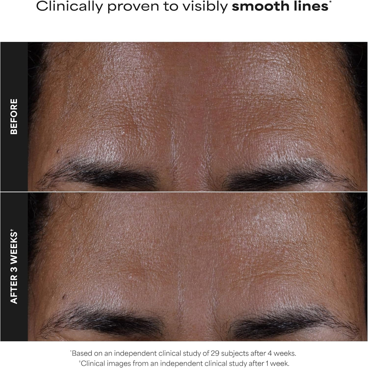 Paula's Choice SKIN PERFECTING 2% BHA Esfoliante Liquido