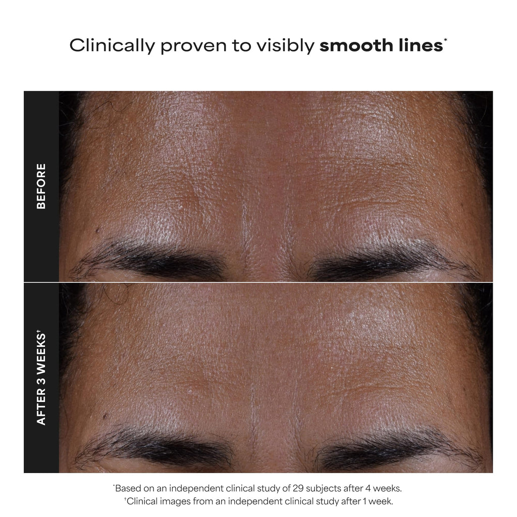 Paula's Choice SKIN PERFECTING 2% BHA Esfoliante Liquido