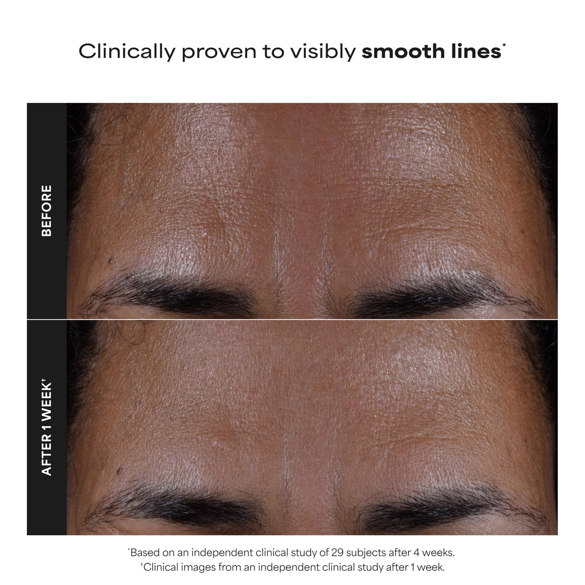 Paula's Choice SKIN PERFECTING 2% BHA Esfoliante Liquido