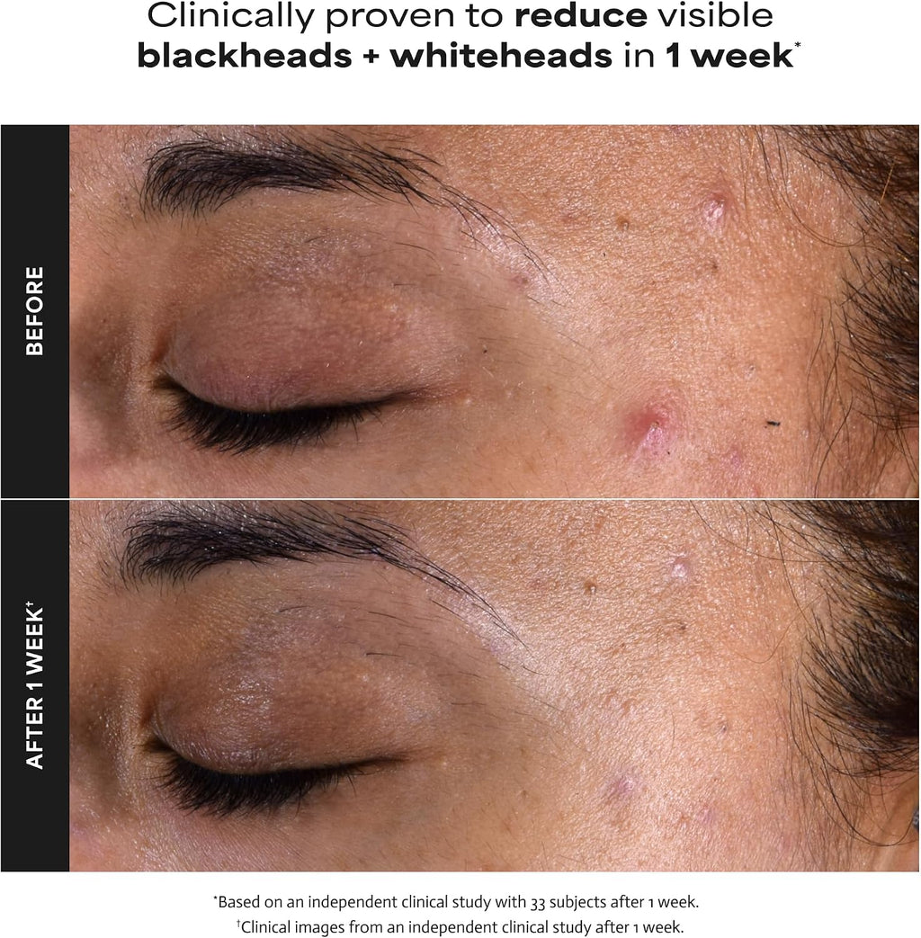 Paula's Choice SKIN PERFECTING 2% BHA Esfoliante Liquido