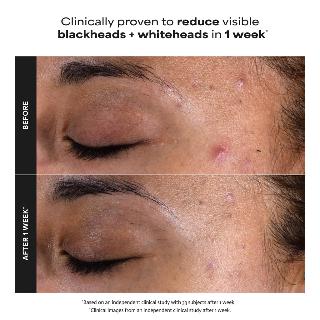 Paula's Choice SKIN PERFECTING 2% BHA Esfoliante Liquido