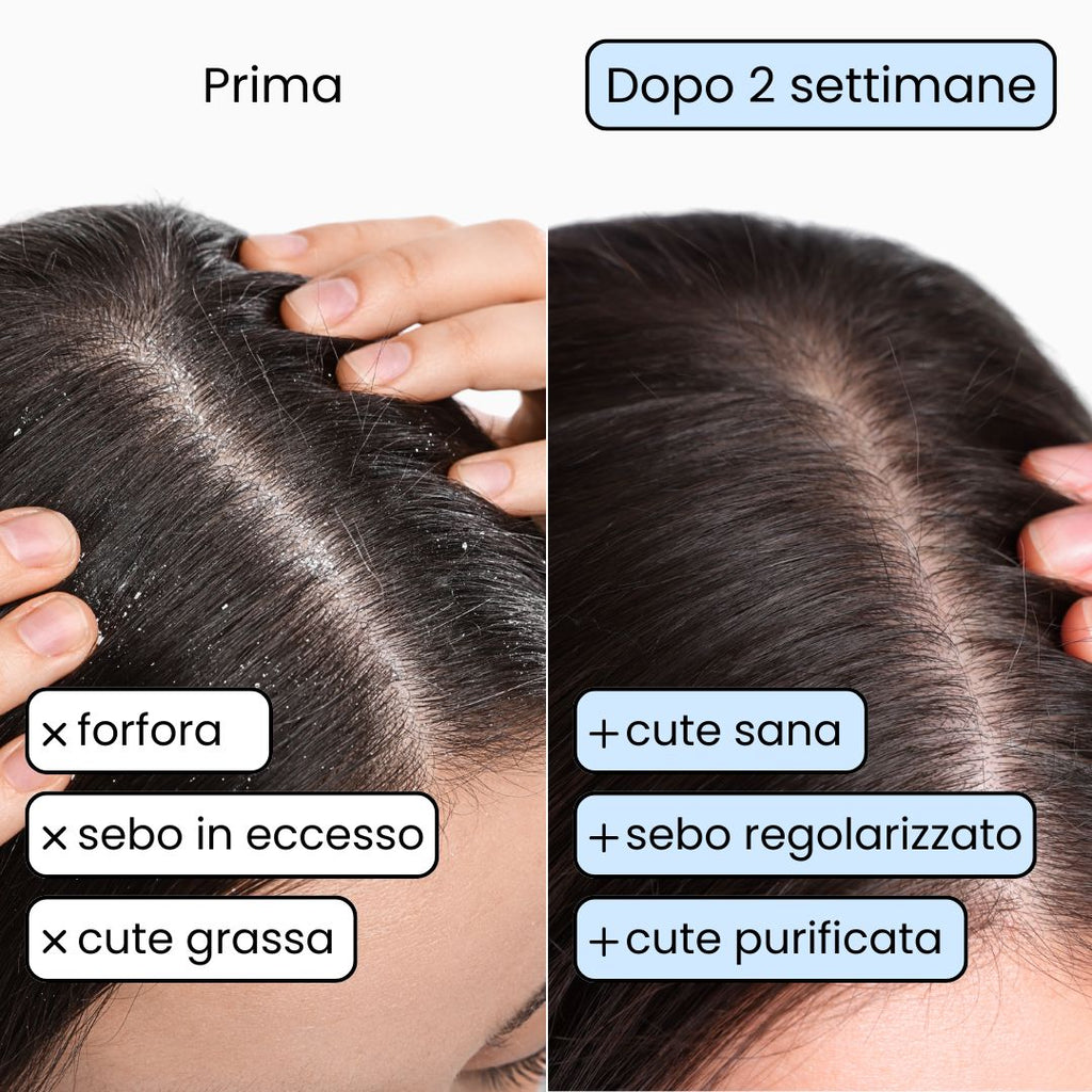 Shampoo Solido Purificante per capelli Grassi x2